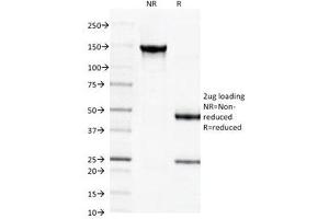 SDS-PAGE Analysis of Purified, BSA-Free Spectrin beta III Antibody (clone SPTBN2/1584). (Spectrin, Beta, Non-erythrocytic 2 (SPTBN2) (AA 356-475) antibody)