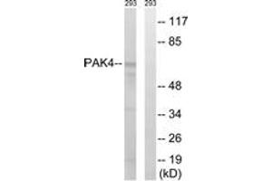 Western blot analysis of extracts from K562 cells, treated with PMA 125ng/ml 30', using PAK4/5/6 (Ab-474) Antibody. (PAK4 antibody  (AA 441-490))