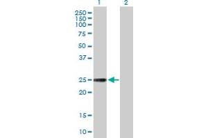 Western Blot analysis of NXNL1 expression in transfected 293T cell line by NXNL1 MaxPab polyclonal antibody. (NXNL1 antibody  (AA 1-212))