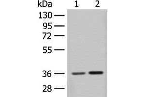 Western blot analysis of Mouse brain tissue and Rat brain tissue lysates using SLC25A27 Polyclonal Antibody at dilution of 1:350 (SLC25A27 antibody)