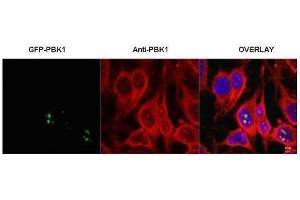 Immunofluorescence microscopy of HeLa cells transfected with GFP-PBK1. (RSL1D1 antibody  (Internal Region))