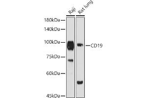 Western blot analysis of extracts of various cell lines, using CD19 antibody (ABIN3023663, ABIN3023664, ABIN3023665 and ABIN6219683) at 1:1000 dilution. (CD19 antibody  (AA 351-556))