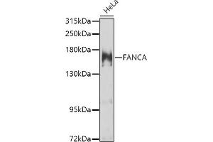 Western blot analysis of extracts of HeLa cells, using FANCA antibody (ABIN6127890, ABIN6140469, ABIN6140470 and ABIN6223595) at 1:1000 dilution. (FANCA antibody  (AA 1-275))