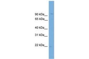 Image no. 1 for anti-Tubulin Polymerization-Promoting Protein Family Member 3 (TPPP3) (N-Term) antibody (ABIN6744722) (TPPP3 antibody  (N-Term))