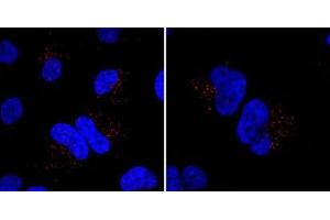 Immunofluorescent staining of Hela cells incubated with MIB Antibody (N-term) (Cat  (ABIN388956 and ABIN2839208)) at a dilution of 1:20. (MIB1 antibody  (N-Term))