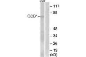 Western Blotting (WB) image for anti-IQ Motif Containing B1 (IQCB1) (AA 431-480) antibody (ABIN2890388) (IQCB1 antibody  (AA 431-480))