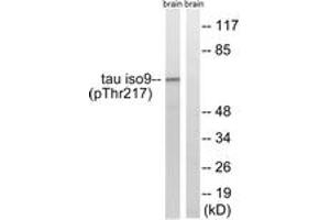 Western blot analysis of extracts from rat brain, using Tau (Phospho-Thr534/217) Antibody.