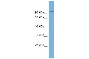 FBXO34 antibody used at 1 ug/ml to detect target protein. (FBXO34 antibody  (Middle Region))