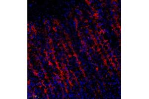 Immunofluorescence of paraffin embedded rat stomach using Treh (ABIN7076006) at dilution of 1:650 (250x lens) (TREH antibody)
