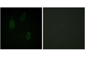 Immunofluorescence analysis of HepG2 cells, using PKC-pan (Phospho-Thr497) Antibody. (PKC antibody  (pThr497))