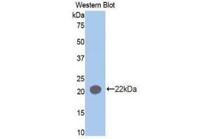 Western Blotting (WB) image for anti-Aminoacyl tRNA Synthetase Complex-Interacting Multifunctional Protein 1 (AIMP1) (AA 148-312) antibody (ABIN1171689) (AIMP1 antibody  (AA 148-312))