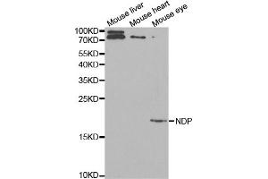 Western blot analysis of extracts of various cell lines, using NDP antibody (ABIN5971016) at 1/1000 dilution. (Norrie Disease (Pseudoglioma) antibody)