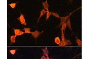 Immunofluorescence analysis of NIH-3T3 cells using CACYBP Polyclonal Antibody at dilution of 1:100. (CACYBP antibody)