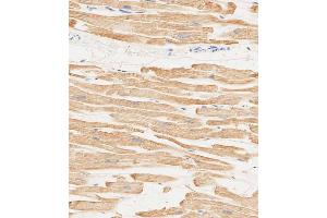 Immunohistochemical analysis of paraffin-embedded human heart tissue using (ABIN6244160 and ABIN6578849) performed on the Leica® BOND RXm. (MYL2 antibody  (AA 42-75))