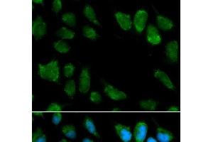 Immunofluorescence analysis of MCF-7 cells using IL1RN Polyclonal Antibody (IL1RN antibody)