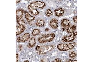 Immunohistochemical staining of human kidney with FLJ22374 polyclonal antibody  shows strong luminal membrane and additional cytoplasmic positivity in renal tubules. (FAM188B antibody)