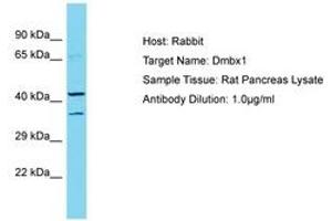 Image no. 1 for anti-Diencephalon/mesencephalon Homeobox 1 (DMBX1) (AA 191-240) antibody (ABIN6750283) (DMBX1 antibody  (AA 191-240))