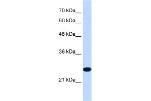 WB Suggested Anti-TMEM109 Antibody Titration:  1. (TMEM109 antibody  (Middle Region))