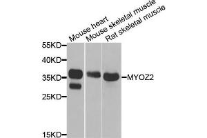 Western blot analysis of extracts of various cells, using MYOZ2 antibody. (MYOZ2 antibody)
