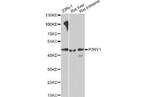 Western blot analysis of extracts of various cell lines, using P2RY1 antibody. (P2RY1 antibody)