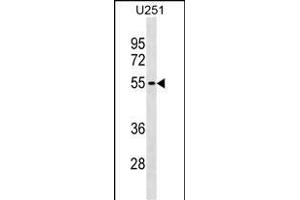 KLHDC7B Antibody (C-term) (ABIN1537171 and ABIN2838249) western blot analysis in  cell line lysates (35 μg/lane). (KLHDC7B antibody  (C-Term))