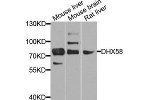 Western blot analysis of extract of various cells, using DHX58 antibody. (DHX58 antibody)
