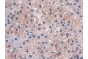 Immunohistochemistry (IHC) image for anti-Pyridoxal Kinase (PDXK) (AA 35-251) antibody (ABIN7440311)