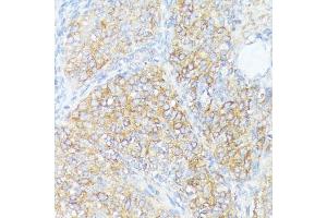 Immunohistochemistry of paraffin-embedded rat ovary using SLC7 antibody (ABIN7270481) at dilution of 1:100 (40x lens). (SLC7A2 antibody  (C-Term))