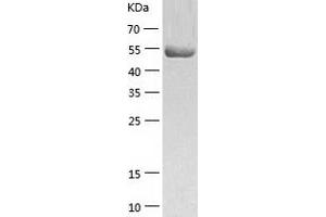 Western Blotting (WB) image for Thioredoxin Reductase 1 (TXNRD1) (AA 2-499) protein (His tag) (ABIN7287396) (TXNRD1 Protein (AA 2-499) (His tag))