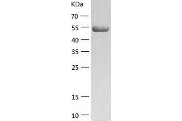 TXNRD1 Protein (AA 2-499) (His tag)