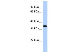 Western Blotting (WB) image for anti-Zinc Finger Protein 511 (ZNF511) antibody (ABIN2458281) (ZNF511 antibody)