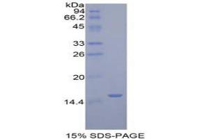 SDS-PAGE analysis of Human Golgi Glycoprotein 1 Protein. (GLG1 Protein)
