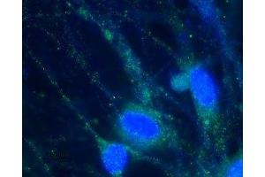 Immunocytochemistry (ICC) image for anti-Hyperpolarization Activated Cyclic Nucleotide-Gated Potassium Channel 2 (HCN2) (AA 147-161), (Intracellular) antibody (ABIN7043279)