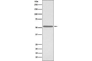 Western blot analysis of Cdc25C expression in K562 cell lysate. (Recombinant CDC25C antibody)