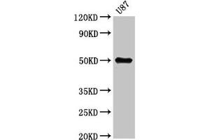 Western Blot Positive WB detected in: U87 whole cell lysate All lanes: URI1 antibody at 5. (URI1 antibody  (AA 180-298))
