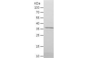 Western Blotting (WB) image for serine Hydroxymethyltransferase 2 (Mitochondrial) (SHMT2) (AA 24-147) protein (His-IF2DI Tag) (ABIN7282912) (SHMT2 Protein (AA 24-147) (His-IF2DI Tag))