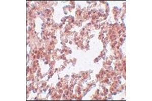 Immunohistochemistry of SRPX2 in rat lung tissue with this product at 5 μg/ml.