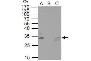 Immunoprecipitation (IP) image for anti-HIV-1 Tat Interactive Protein 2, 30kDa (HTATIP2) antibody (ABIN2857073)