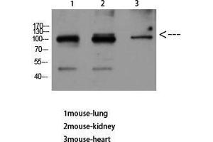 Western Blot (WB) analysis of Mouse Lung Mouse Kidney Mouse Heart using VE-Cadherin Polyclonal Antibody diluted at 1:500. (Cadherin 5 antibody  (Internal Region))