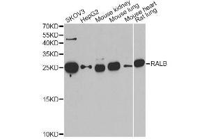 Western blot analysis of extracts of various cell lines, using RALB antibody. (RALB antibody  (AA 1-206))