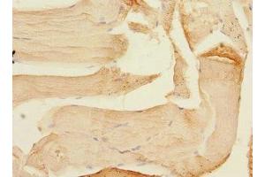 Immunohistochemistry of paraffin-embedded human skeletal muscle tissue using ABIN7160069 at dilution of 1:100 (MAP4K3 antibody  (AA 755-894))