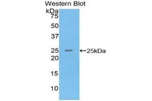 Detection of Recombinant SPRY3, Human using Polyclonal Antibody to Sprouty Homolog 3 (SPRY3) (SPRY3 antibody  (AA 91-288))