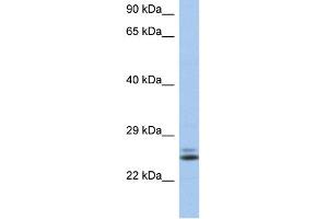 WB Suggested Anti-RAB15 Antibody Titration: 0. (RAB15 antibody  (N-Term))