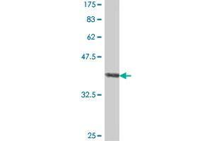 Western Blot detection against Immunogen (38. (GNE antibody  (AA 1-110))