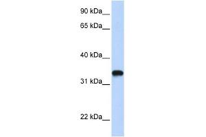 HAS3 antibody used at 1 ug/ml to detect target protein. (HAS3 antibody  (C-Term))