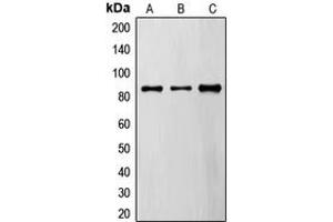 Western blot analysis of FYB expression in A549 (A), MDAMB435 (B), TF1 (C) whole cell lysates. (FYB antibody  (C-Term))