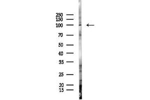 anti-Desmocollin 1 (DSC1) antibody