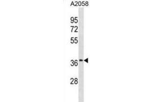 Western Blotting (WB) image for anti-Olfactory Receptor, Family 52, Subfamily J, Member 3 (OR52J3) antibody (ABIN3001032)
