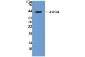 Detection of Recombinant TPS, Human using Polyclonal Antibody to Tryptase (TPS) (TPSAB1 antibody  (AA 161-262))