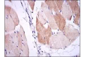 Immunohistochemical analysis of paraffin-embedded muscle tissues using IL1B mouse mAb with DAB staining.